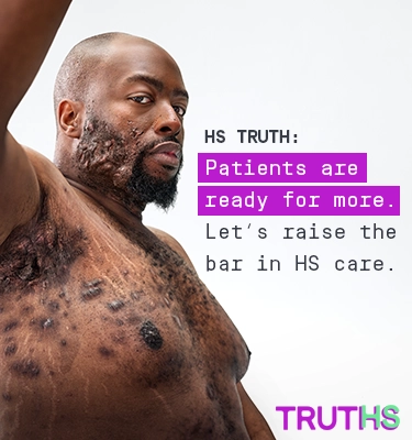 To the left of the image, a Black man, with hidradenitis suppurativa (HS), poses looking into the camera with his right arm up, showing scars from his HS flares. To his right reads a headline "HS TRUTHS: Patients are ready for more. Let's raise the bar in HS care." Below is the TRUTHS logo with the HS in TRUTHS highlighted in teal. 