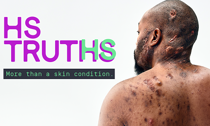To the right of the image, a Black man, with hidradenitis suppurativa (HS), poses facing away from the camera with his back exposed, showing scars from his HS flares. To his left reads a headline "HS TRUTHS more than a skin condition.