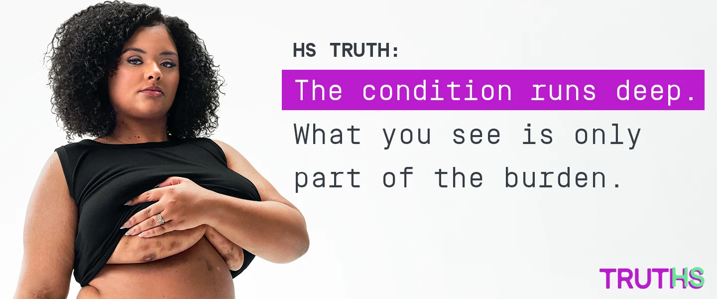 To the left of the image, a Black woman poses looking into the camera while lifting up her shirt, showing scars from her hidradenitis suppurativa (HS) flares under her right and left breast. To her right reads a headline "HS TRUTHS: The disease runs deep. What you see is only part of the burden." Below the headline is a tag with the patients name which reads "Jasmine, real HS patient. To the right is the TRUTHS logo with the HS in TRUTHS highlighted in teal. 