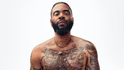 A Black man, with hidradenitis suppurativa (HS), poses with a look of defiance into the camera.