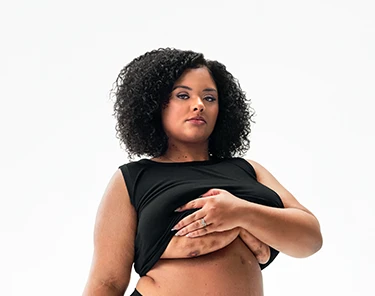 To the left of the image, a Black woman poses looking into the camera while lifting up her shirt, showing scars from her hidradenitis suppurativa (HS) flares under her right and left breasts. To her right reads a headline: "HS TRUTH: HS runs deep. What you see is only part of the burden." Below the headline is a tag with the patient's name which reads "Jasmine S, real HS patient."