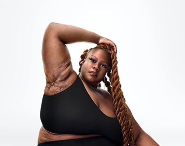 To the left of the image, a Black woman poses with long braids and a powerful expression with her face towards the camera and her right arm up showing scars from her hidradenitis suppurativa (HS) flares. To her right reads a headline: "HS TRUTH: HS hits harder than you think. Learn the TRUTHS of HS." Below the headline is a tag with the patient's name which reads "Jasmine E, real HS patient."  