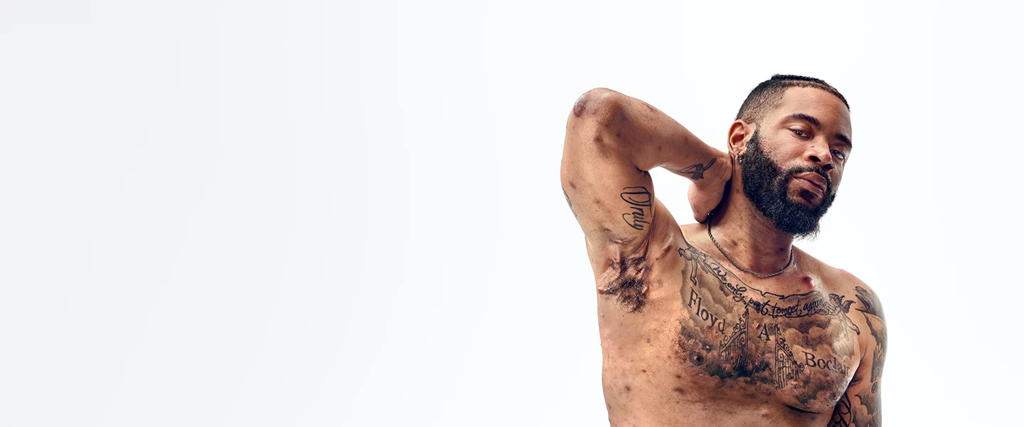 To the right of the image, a Black man with a beard, and hidradenitis suppurativa (HS), poses facing the camera with his tattooed chest exposed, with his arm up to show scars from his HS flares. To his left reads a headline: "HS TRUTH: HS Education & Resources | Learn more about the science behind HS and how patients with HS navigate their lives". Below the photo is a tag with the patient's name which reads "Jawan, real HS patient." 