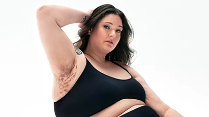 A White woman who has brown hair poses looking into the camera with her right arm up, showing scars from her hidradenitis suppurativa (HS) flares.