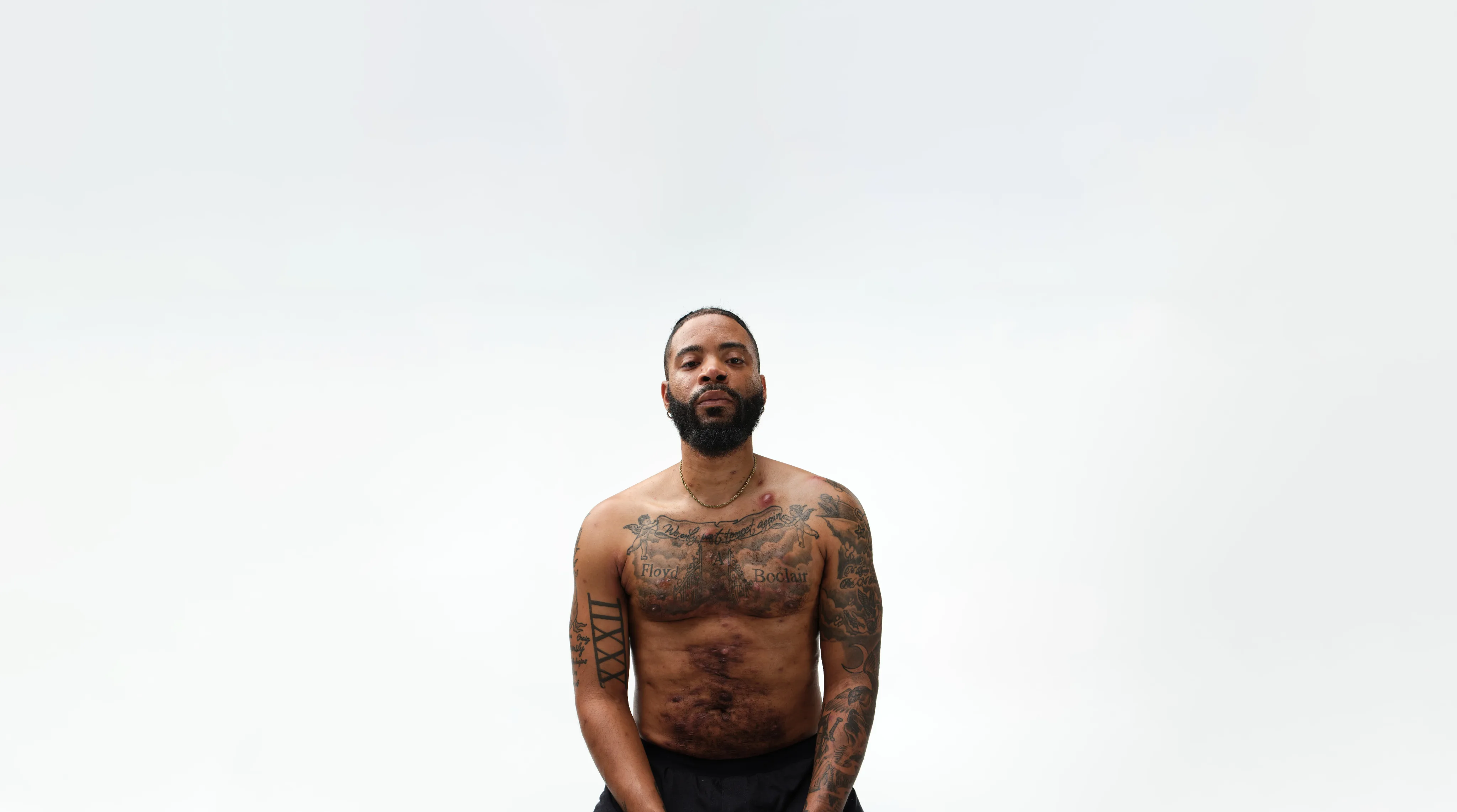 A Black man, with hidradenitis suppurativa (HS), poses with a look of defiance into the camera.